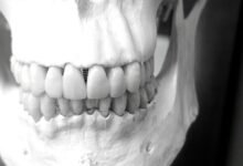 surgical tech study guide summary
